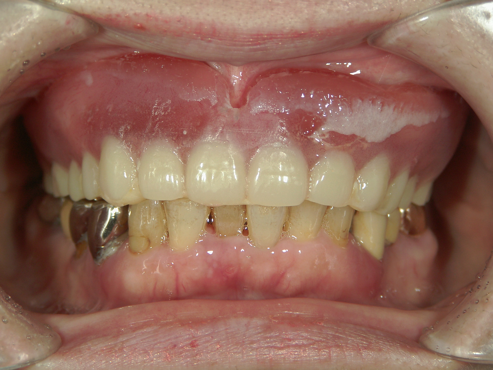 PICT1192.JPG